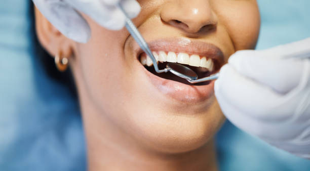 Best Cosmetic Emergency Dentistry in Appleton, WI